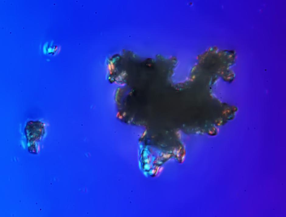 �@�M�DƬ��ͨ�^�@΢�R�������w���Ŵ�1000���󣬰l�F�����Π�������Џͺ��w���������w�����еV���|�ģ�����ȥ�|Ŀ�@�ġ�